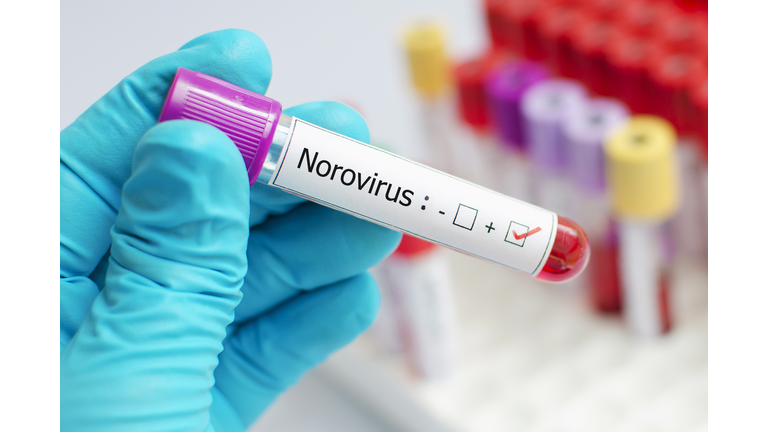 Norovirus positive blood tube