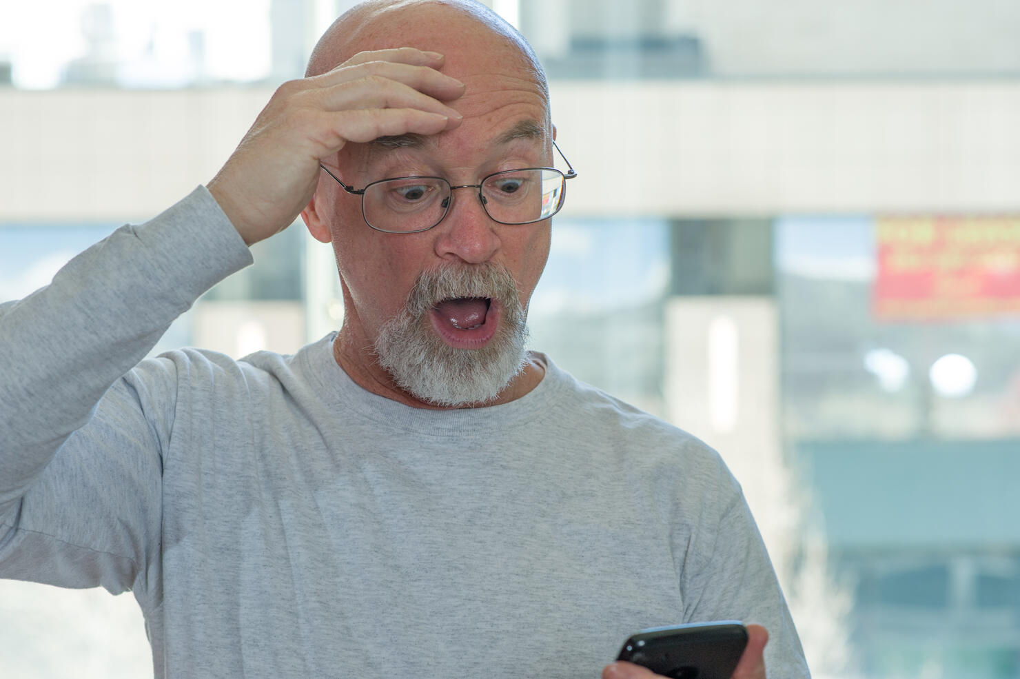 British Court Has Ruled That Calling Men Bald Is Sexual Harassment Iheart 