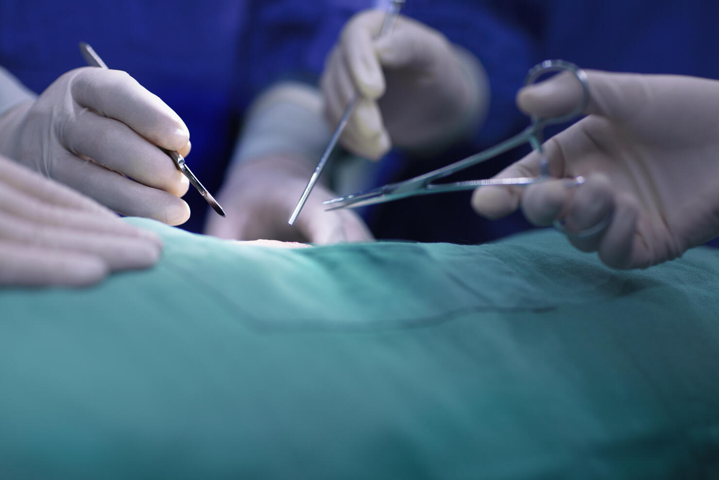 Hands of operating room staff performing surgery
