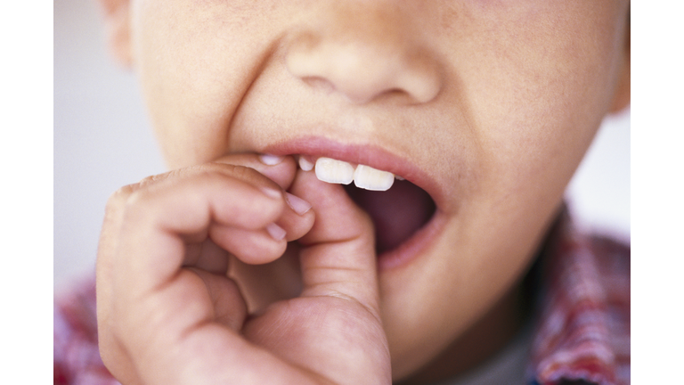 Boy with loose tooth