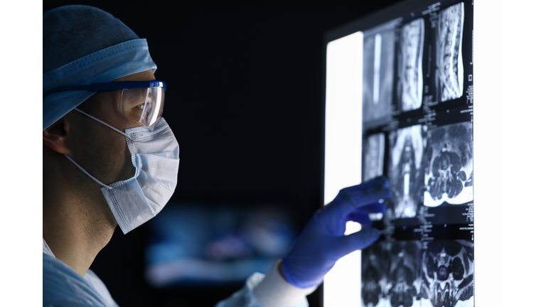 Male doctor in surgical clothes looking at vertebral mri scan