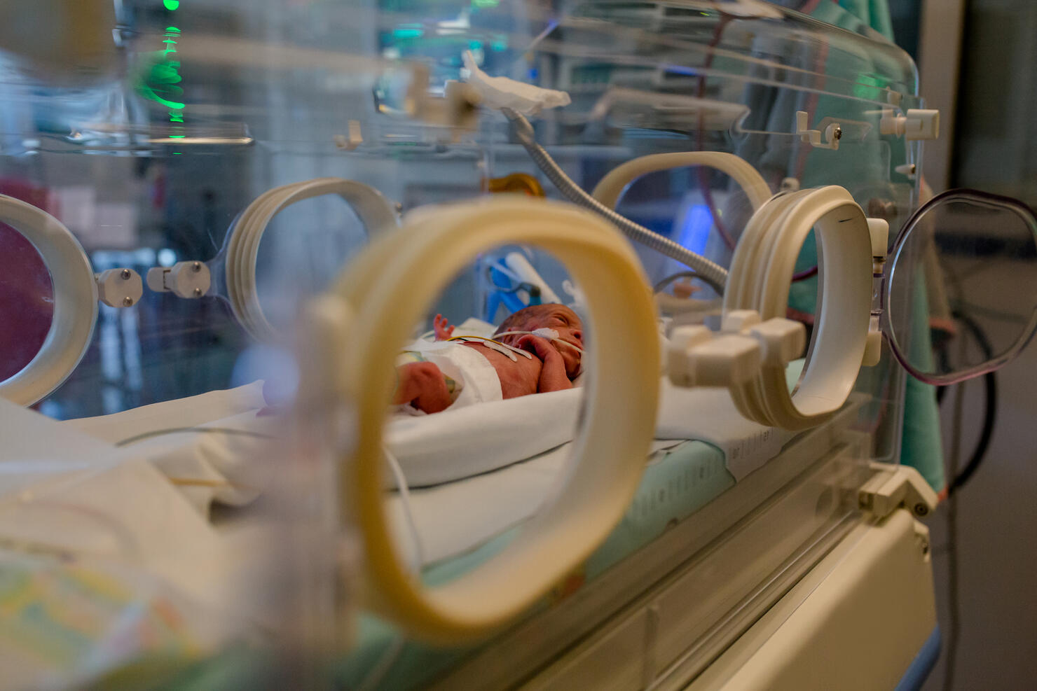 premature baby lies in the incubator