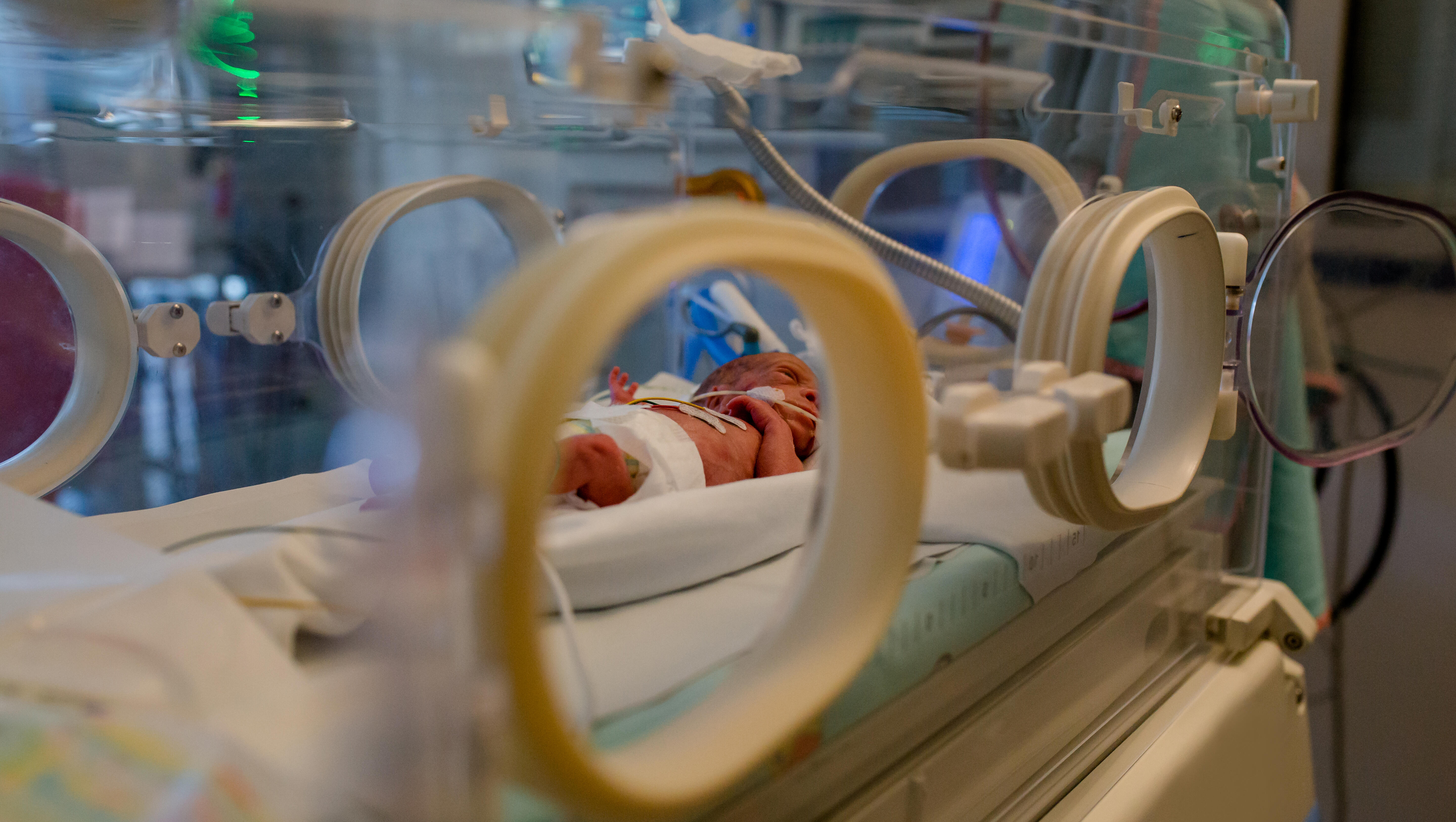 World's Most Premature Baby Miraculously Reaches 1st Birthday