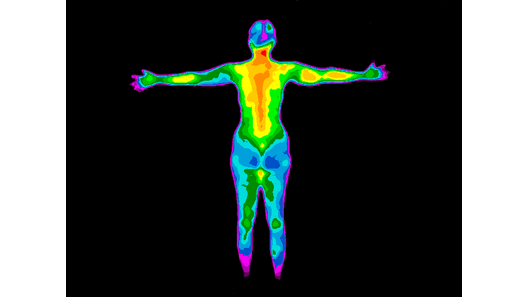 Thermography Whole Body Back