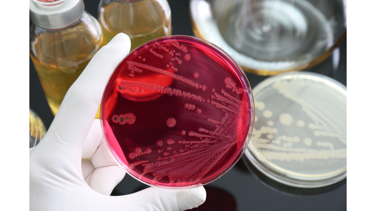 Salmonella was growth in (selective medium) XLD agar