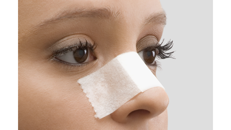 Close-up of a female patient with an adhesive bandage on her nose