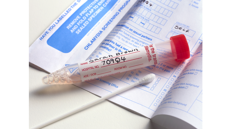 Chlamydia screening smear test