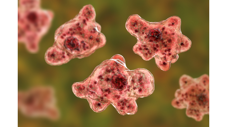 Brain-eating amoeba infection, naegleriasis