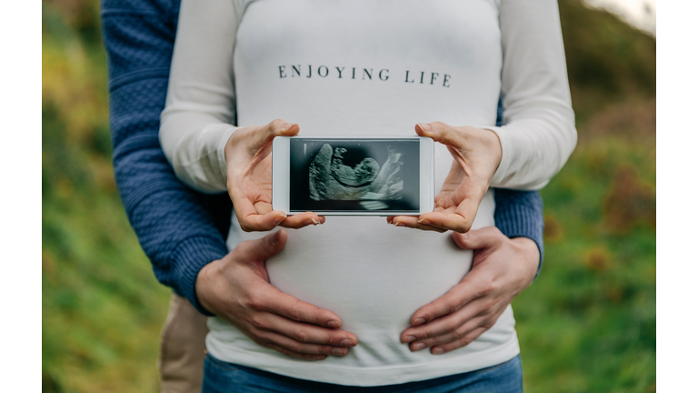 Pregnant showing ultrasound on the mobile with her partner