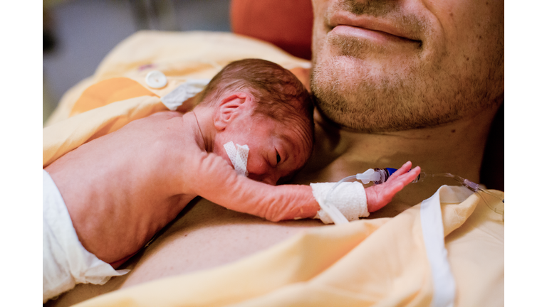 premature baby lies on dad's chest