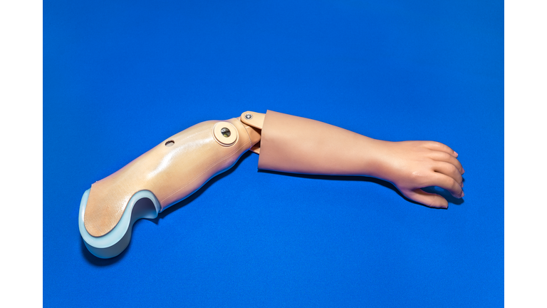 Single prosthetic arm over blue background.