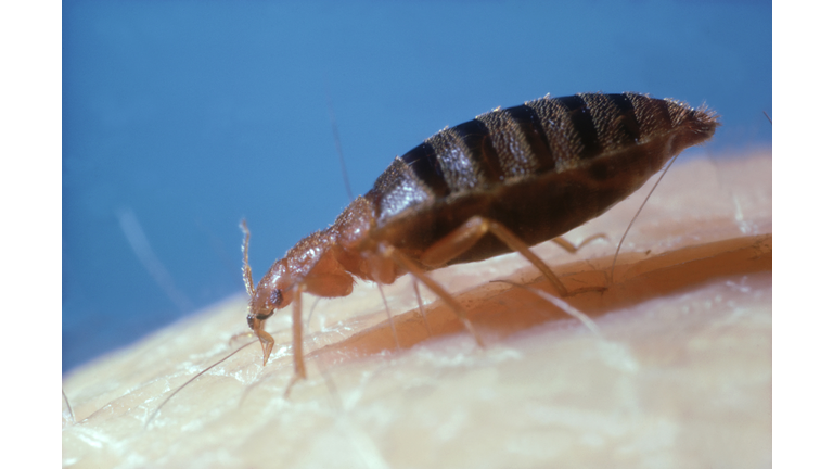 bed-bug: cimex lectularius  on human