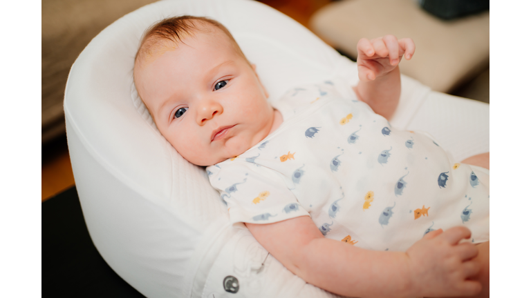 infant on a white lounger. seborrheic dermatitis on the baby's head.