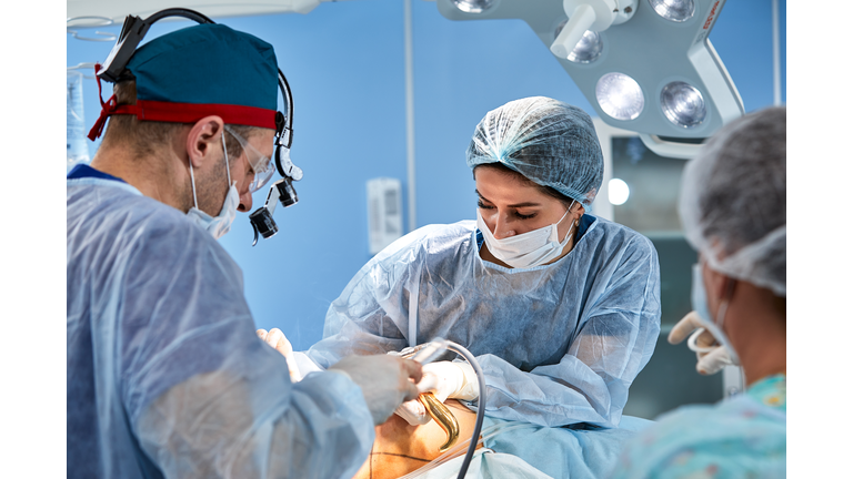 cosmetic liposuction surgery in actual operating room setting showing surgeons group during operation