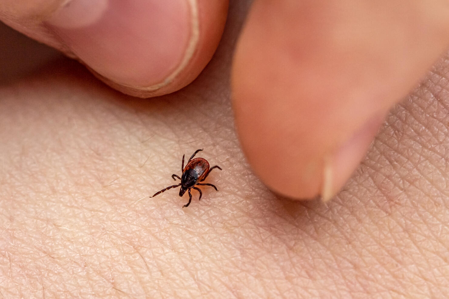 The fingers of the hand catch an encephalitis forest tick crawling on human skin. Danger of insect bite and human disease