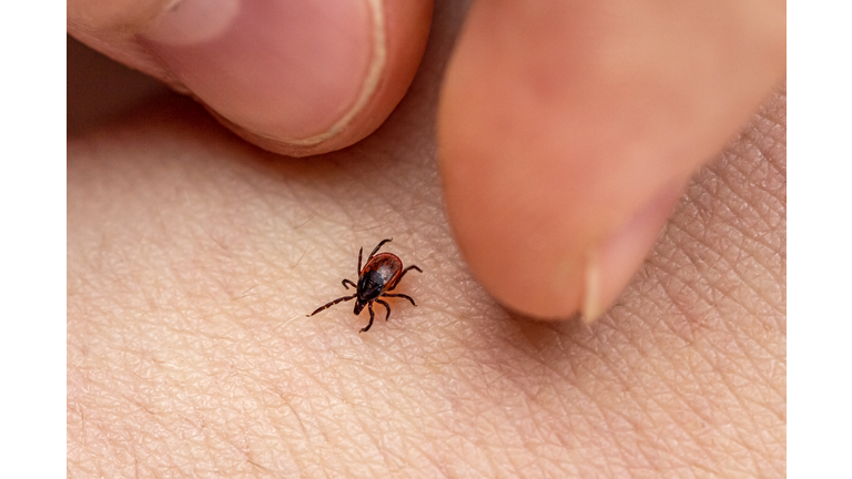 The fingers of the hand catch an encephalitis forest tick crawling on human skin. Danger of insect bite and human disease