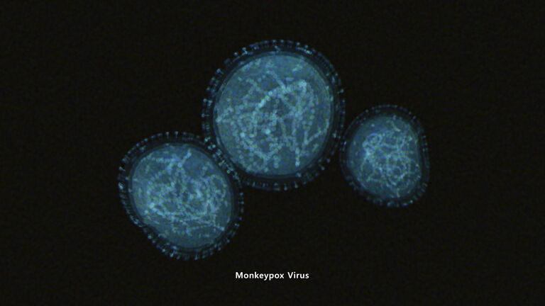 Monkeypox Virus