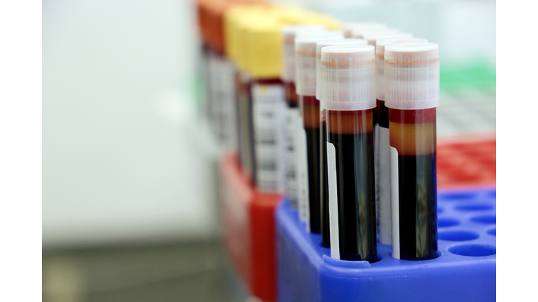 Vials of blood in the medical laboratory