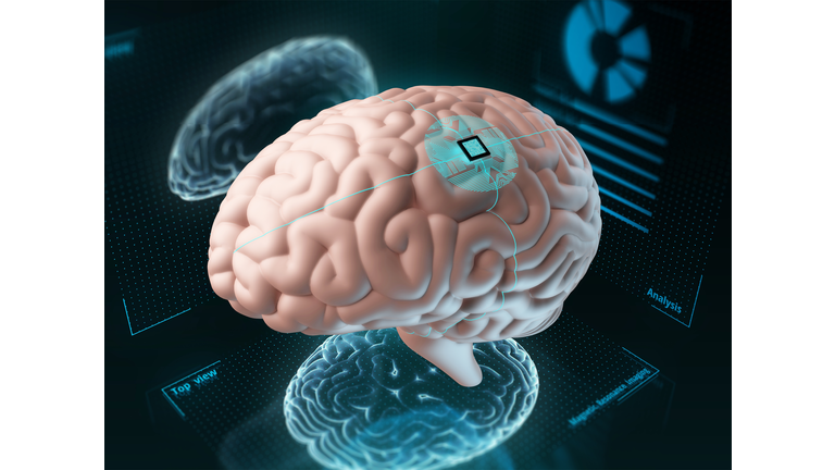 Chip implanted in human brain, illustration