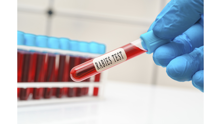 Rabies blood test, conceptual image