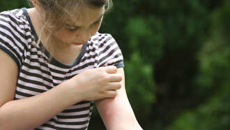 Can Pimple Patches take the itch out of bug bites?