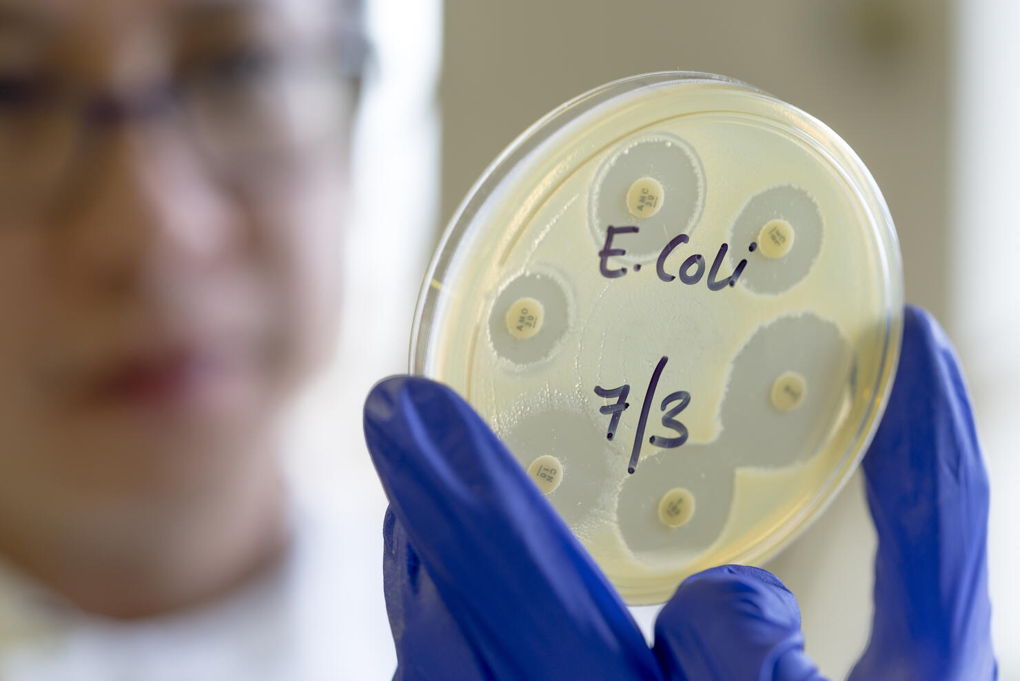 Microbiologist holding an antibiotic sensitivity plate of an E. coli bacteria