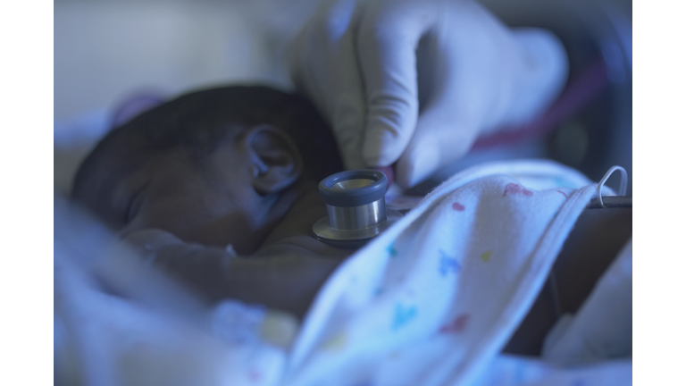 African American premature baby being examined