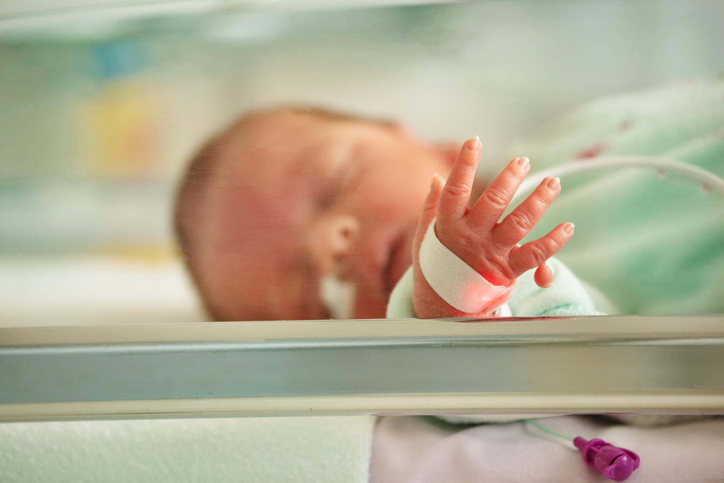 Supernumerary finger, Polydactyly case of newborn portrait
