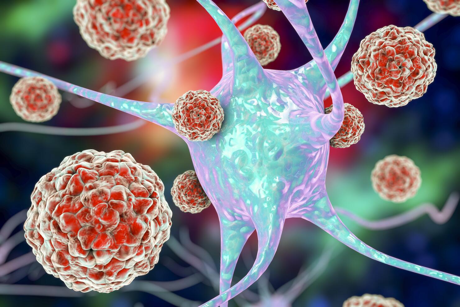 Enteroviruses and neuron, illustration