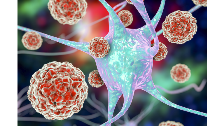 Enteroviruses and neuron, illustration