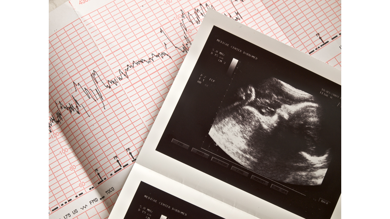Medicine tests of the fetus