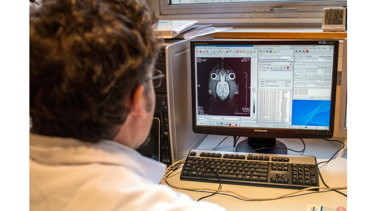 FRANCE-HEALTH-MEDECINE-RESEARCH