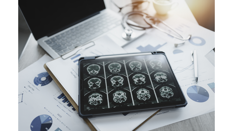 Close-up of a digital tablet with brain x-ray on screen.