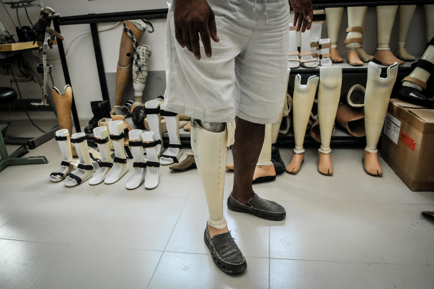 man-say-american-airlines-lost-prosthetic-leg-and-won-t-reimburse-him