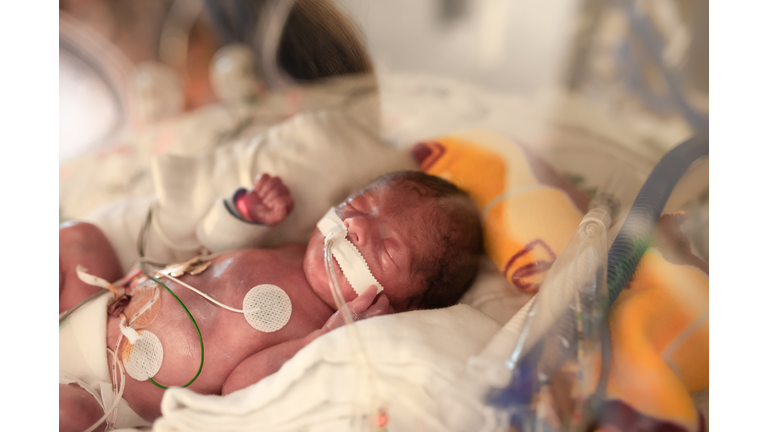 29 Week Premature Baby Is Seen in Hospital With Medical Equipment