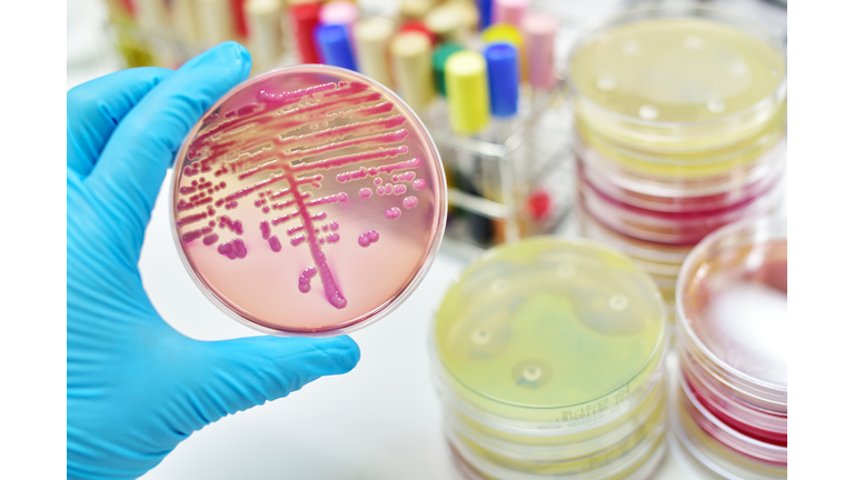 Bacteria Culture