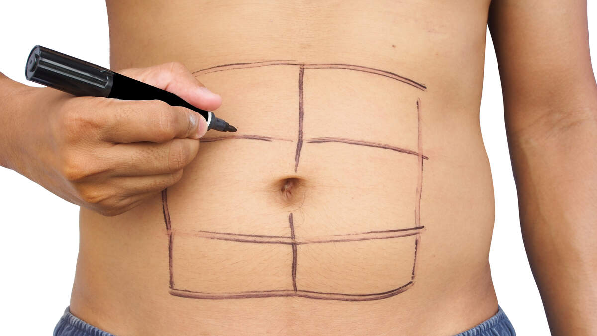 Abdominal Etching (Six Pack Abs) Maryland, Baltimore