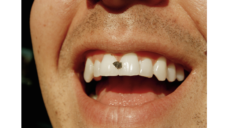 Man with food in his teeth