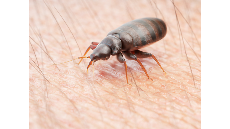 Illustration of a bedbug on human skin