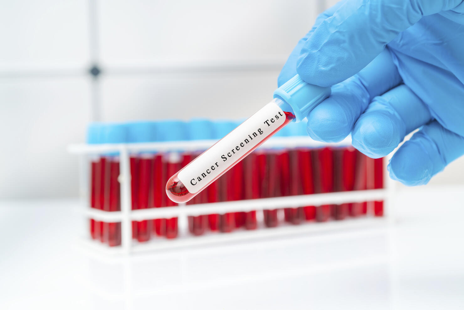 Colon cancer blood test, conceptual image