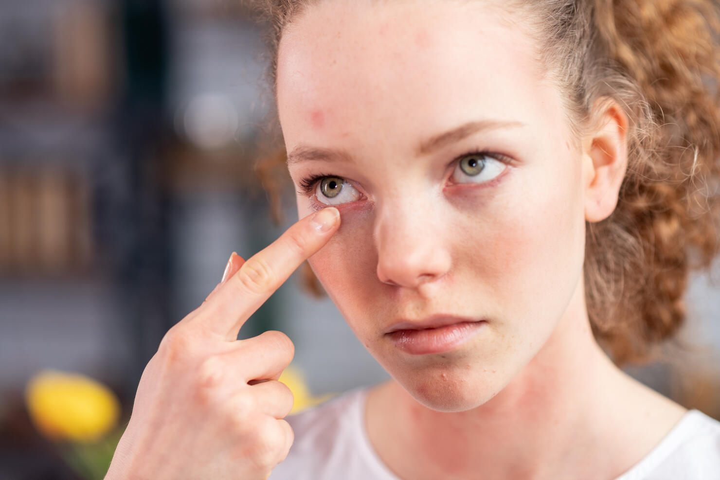 Unfortunate young lady with curly hair itching her eyelid