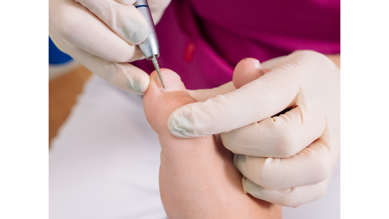 Podiatrist treating a patient's foot in the consultation room