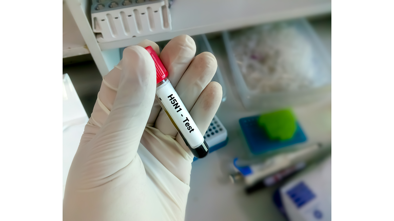 Blood sample for H5N1 test