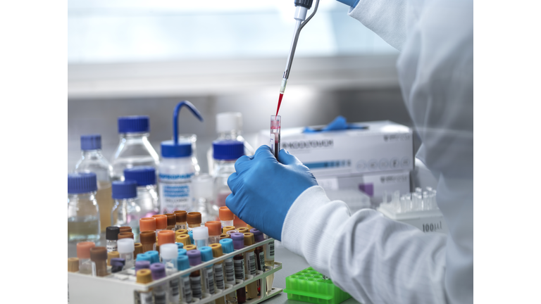 Pathologist pipetting blood sample in test tube at laboratory