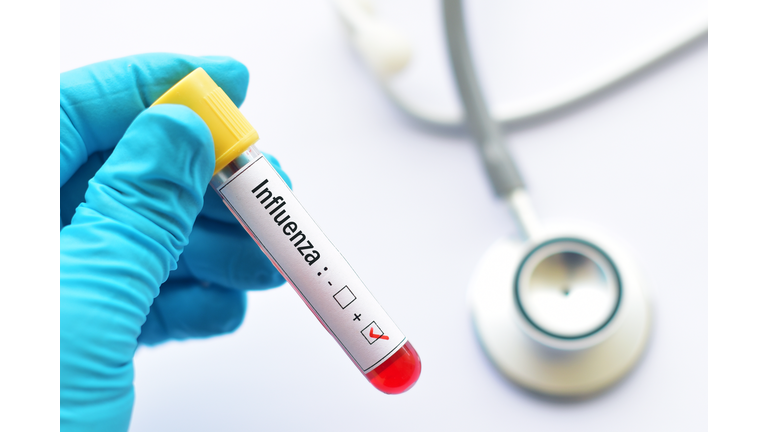 Influenza positive