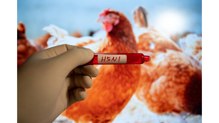 Blood collection tubes H5N1 test positive results,Medical health concept