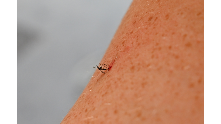 FRANCE-TIGER-MOSQUITO-AEDES-ALBOPICTUS-SCRATCHED