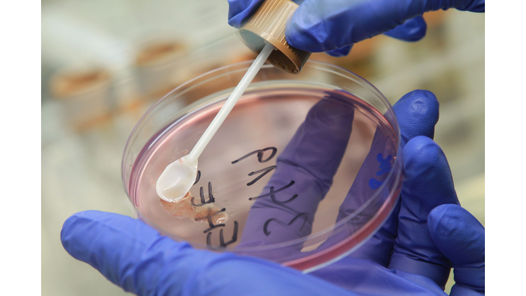 Health Authorities Seek Clues To EHEC Outbreak