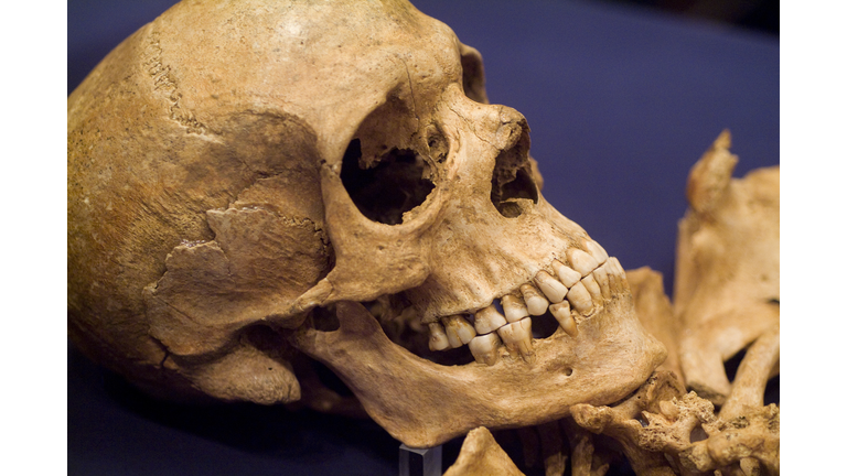 Skull of Early Settler
