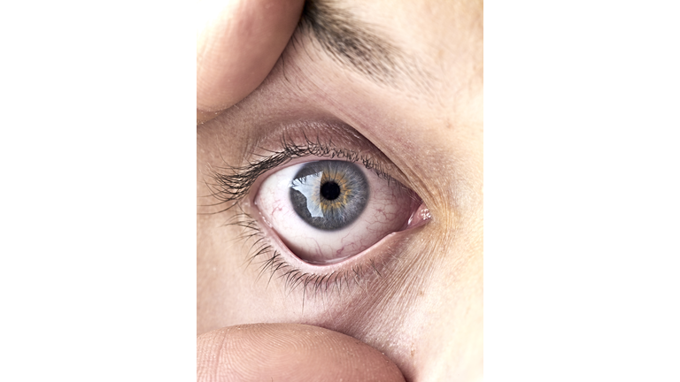 human eye, wide and fixed, skin